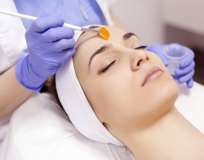 chemical peels, what to do next